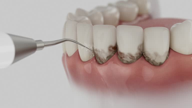 Reliable Dental contractor in Amelia, OH by Smile Center Dentistry